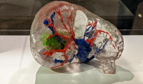 3D printed liver