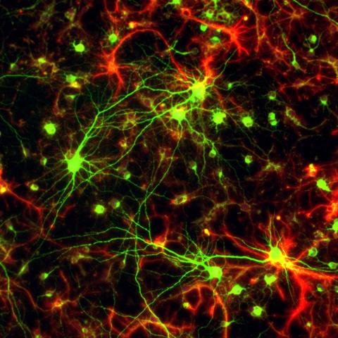 Glial Cells and Neurons