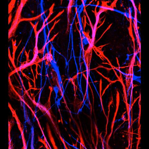Neurons Created from Human Skin Cells