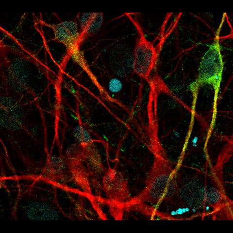 Neurons Derived From Human Skin Cells