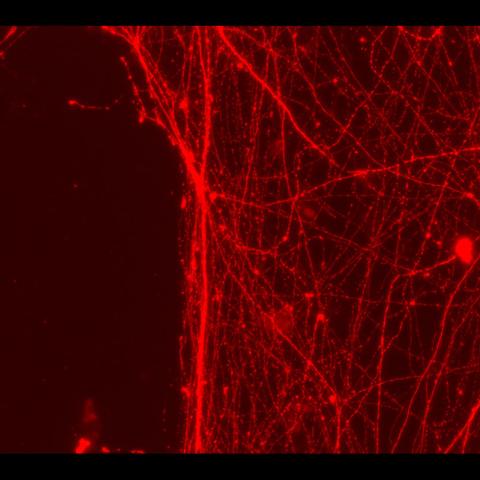 Neurons Grown Within a Microscopic Channel