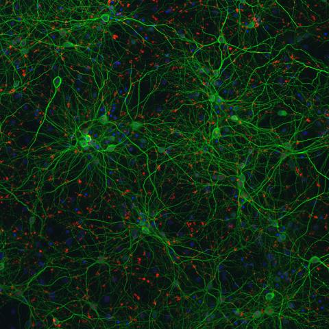 Mouse Neurons Used to Study Lou Gehrig's Disease