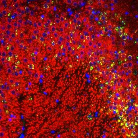 Mouse Neurons Used to Study LaCrosse Virus Encephalitis